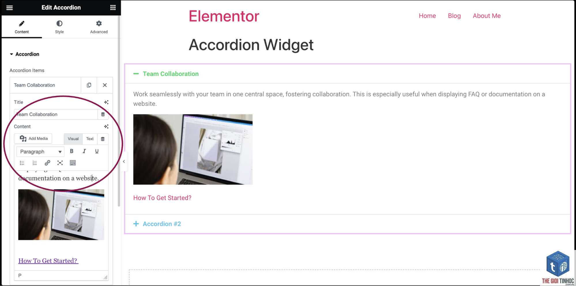 accordion widget elementor - Hình 5