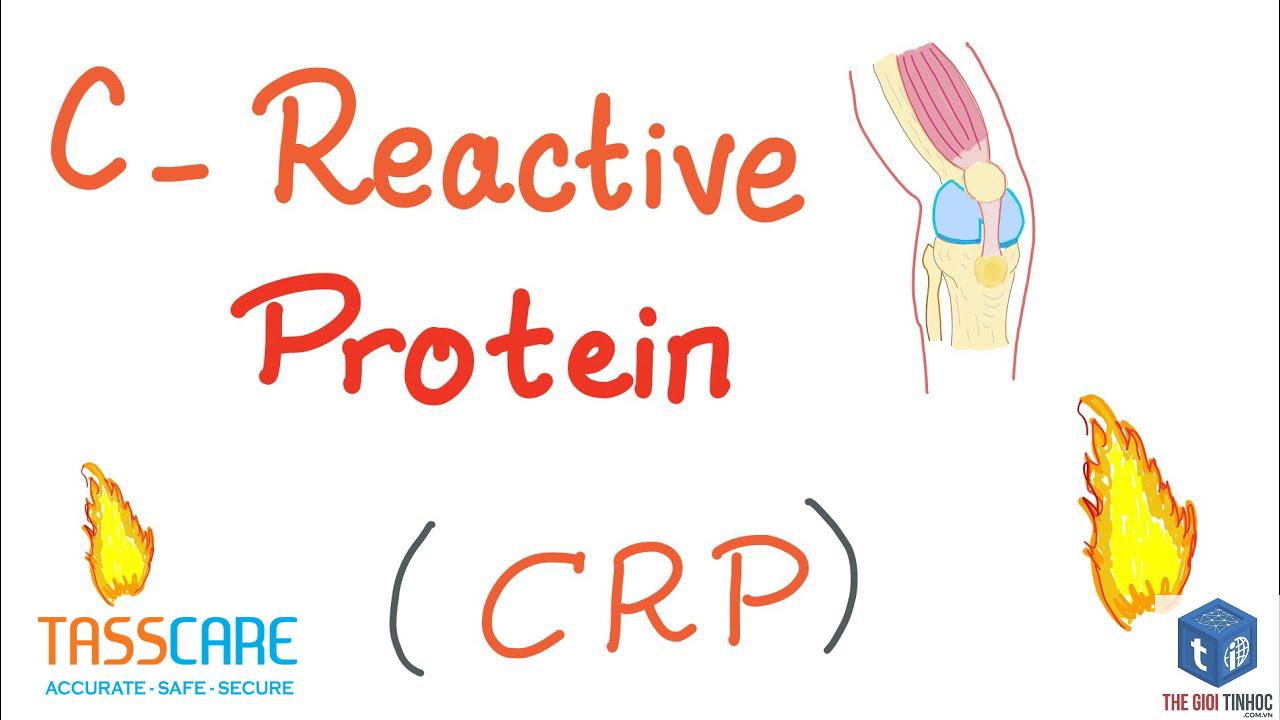reactive pr là gì - Hình 4